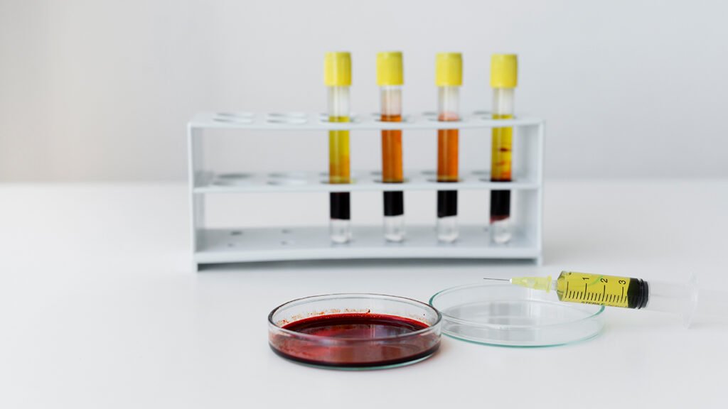 Cryoprecipitate