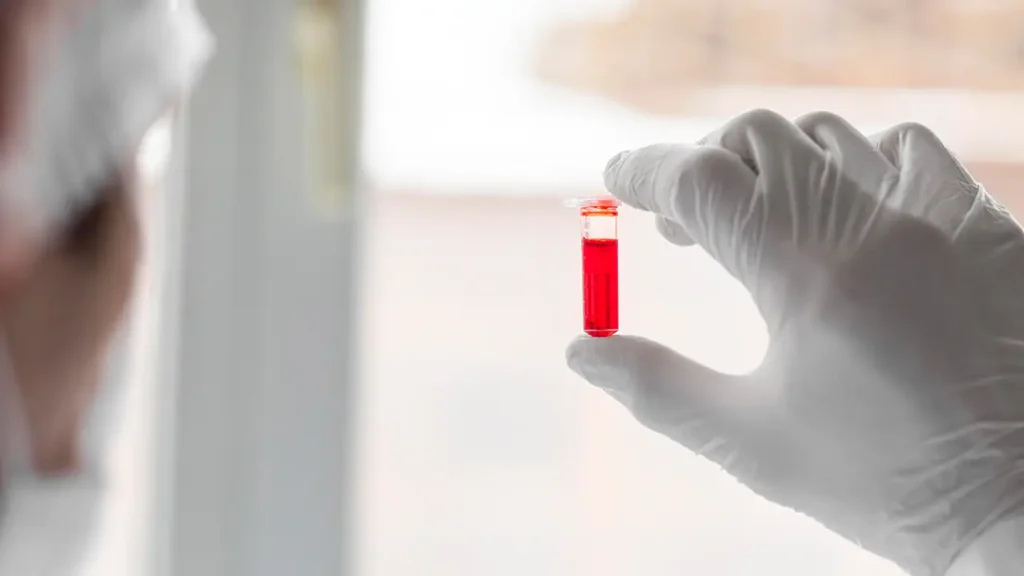Packed Red Blood Cells